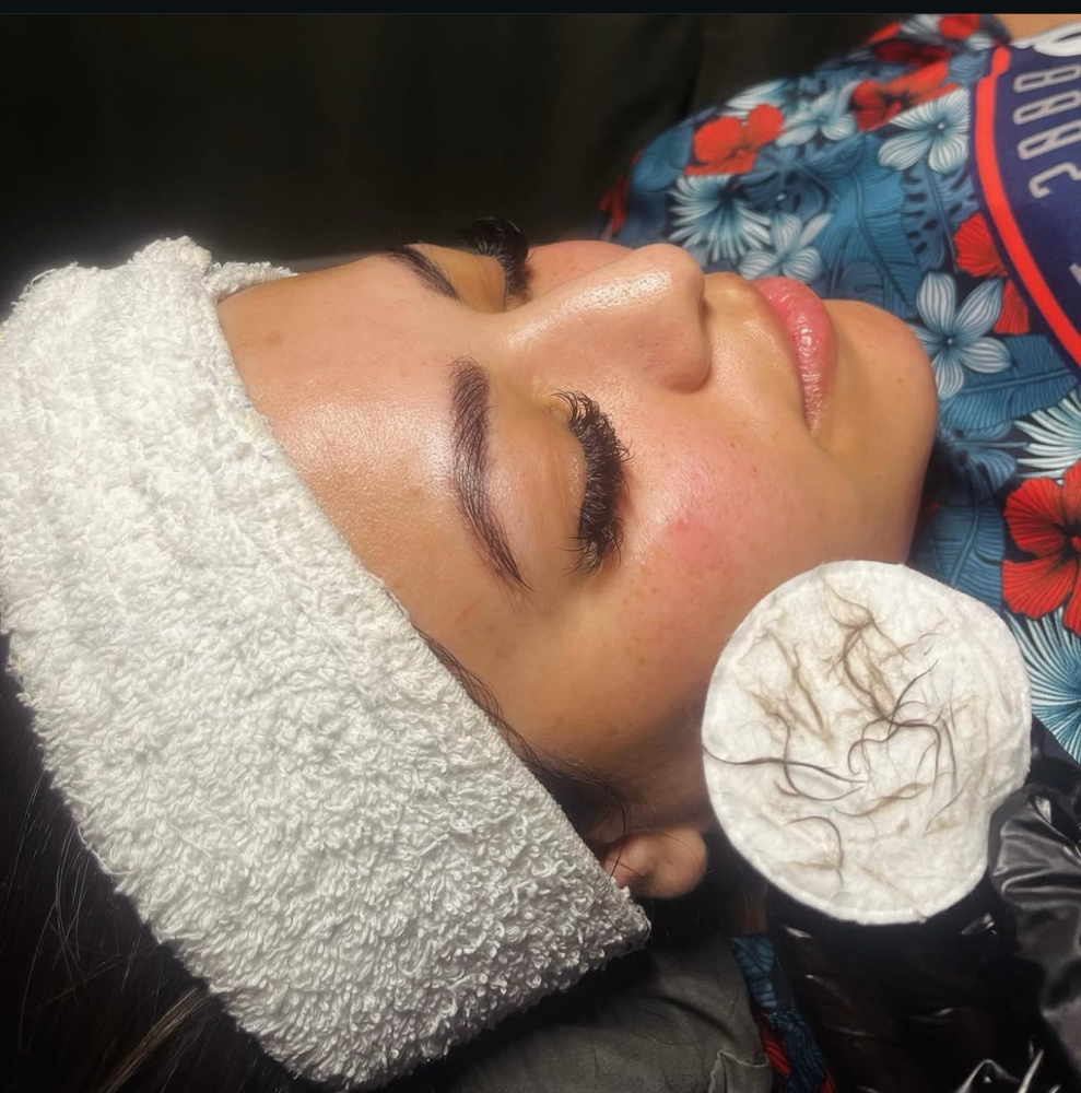Express Dermaplane