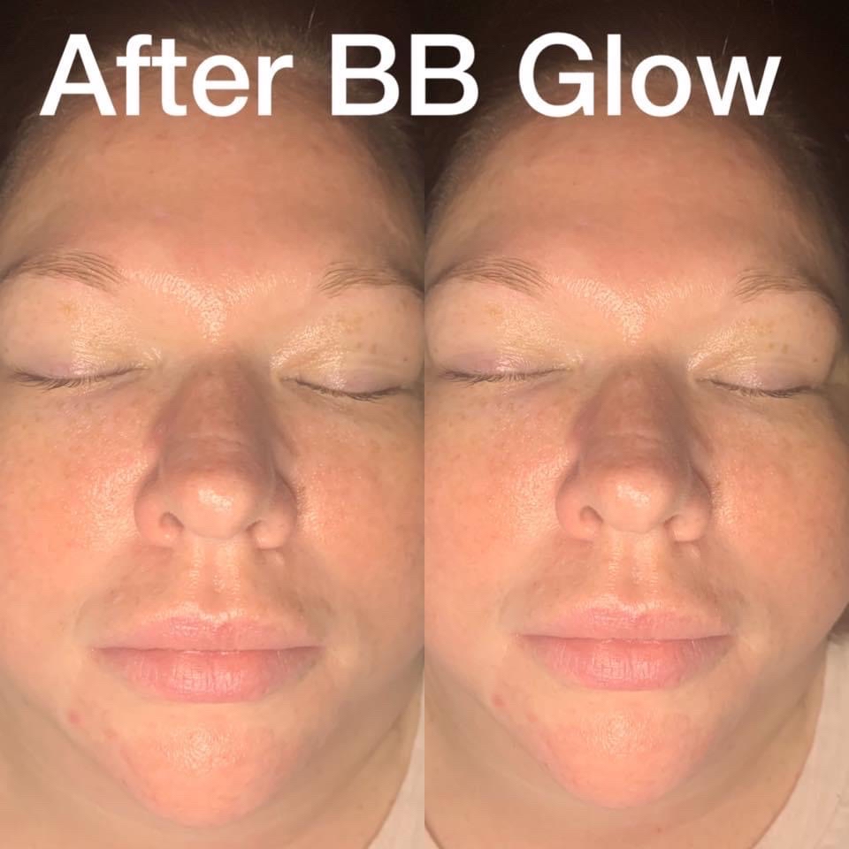 BB Glow Facial