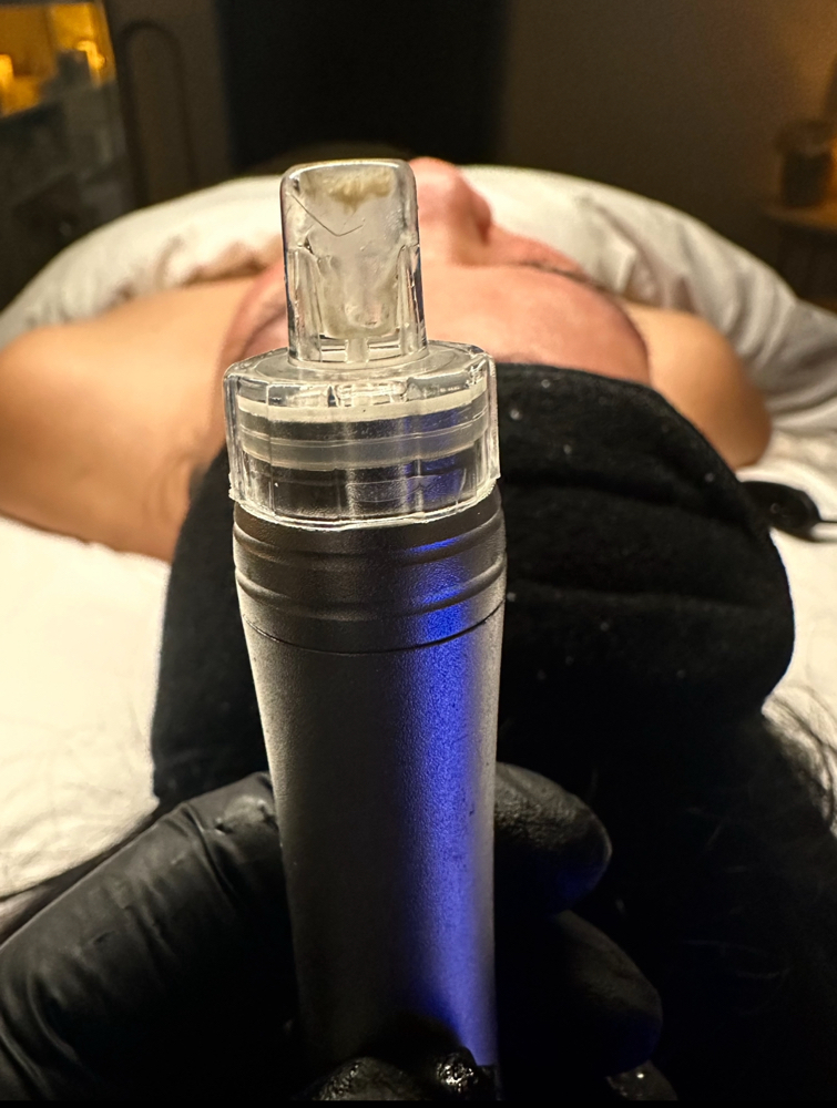 Alchemy Facial (HydroDerm)
