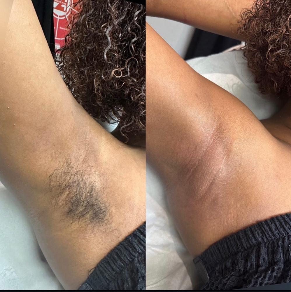 Underarm wax