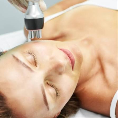RF Skin Tightening Treatment at Restore Face and Body Studio in Osage Beach, MO