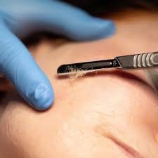 Dermaplane Facial