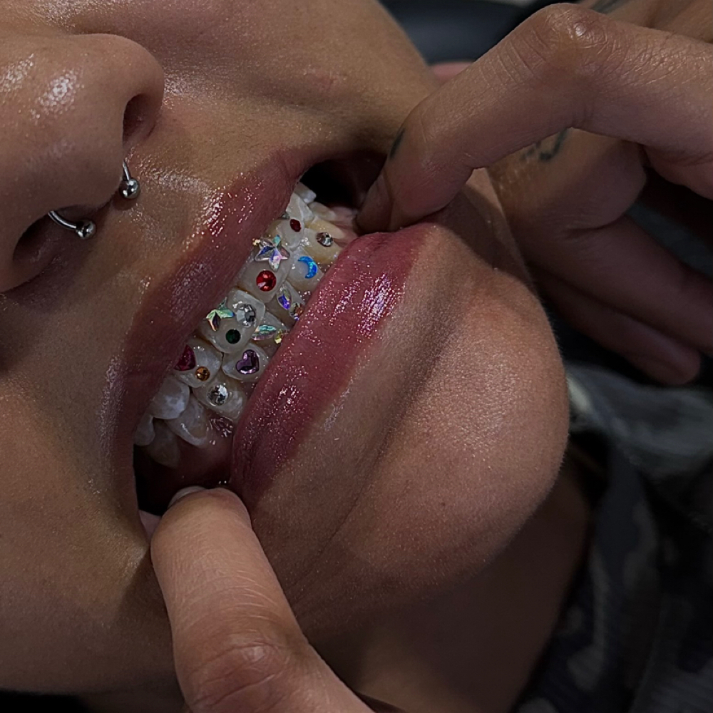 Large Tooth Gem Design/Freestyle at JCR Piercings in Waukegan, IL