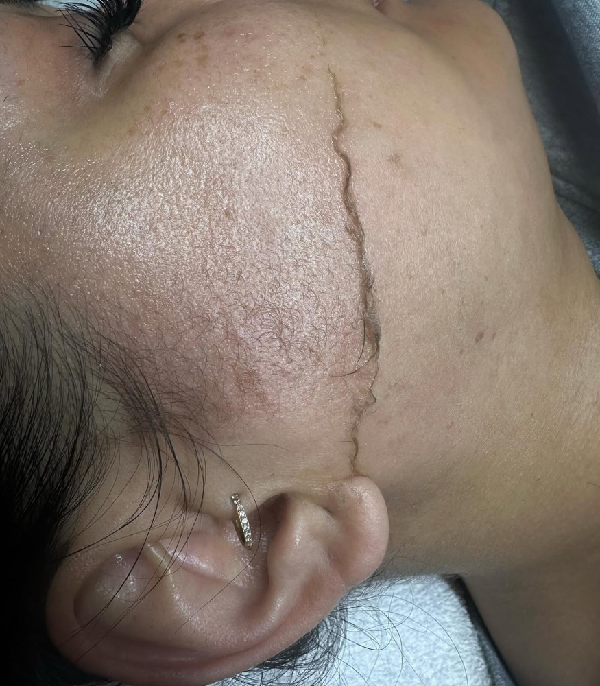 Dermaplane Only-No Facial