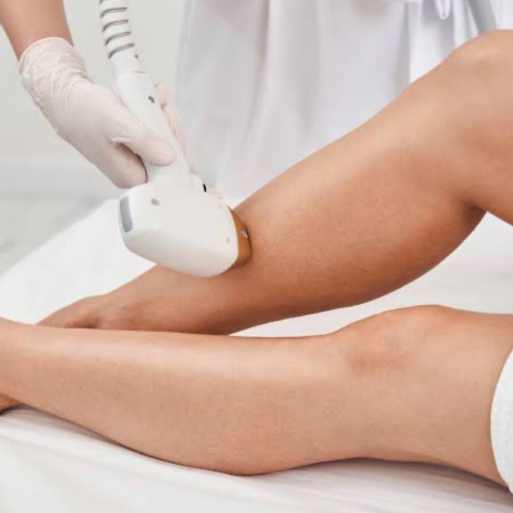 ✨NEW✨LASER HAIR REMOVAL