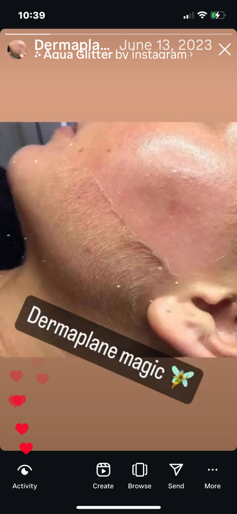 Hydrofacial & Dermaplane