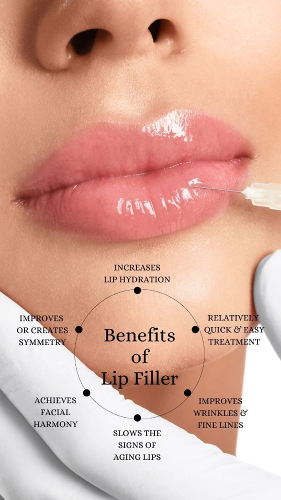 💋 LIP FILLER PROMO JULY 26 ONLY