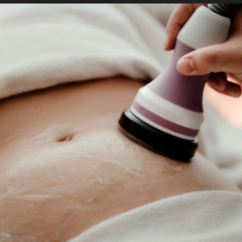 Body Contouring Large Area at K.Xsthetics in Lavon, TX