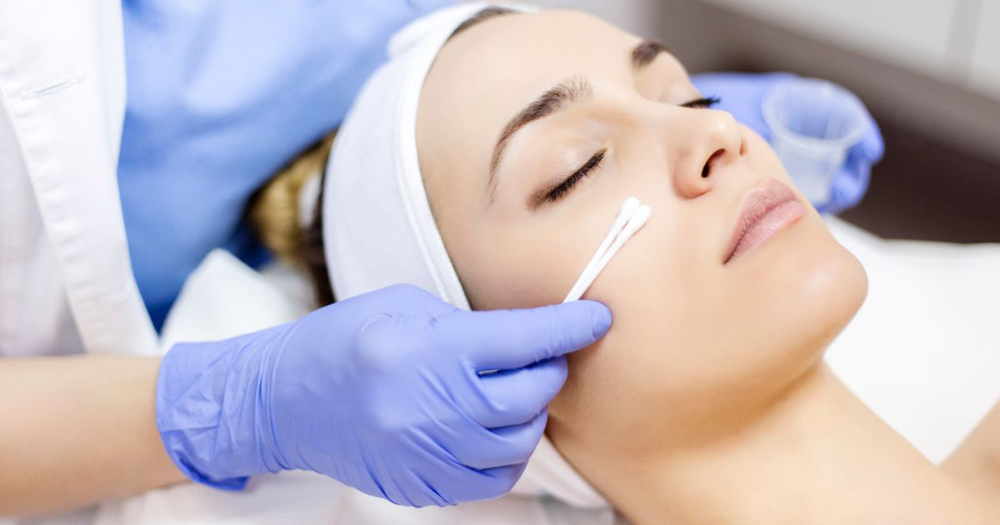 Chemical Peel