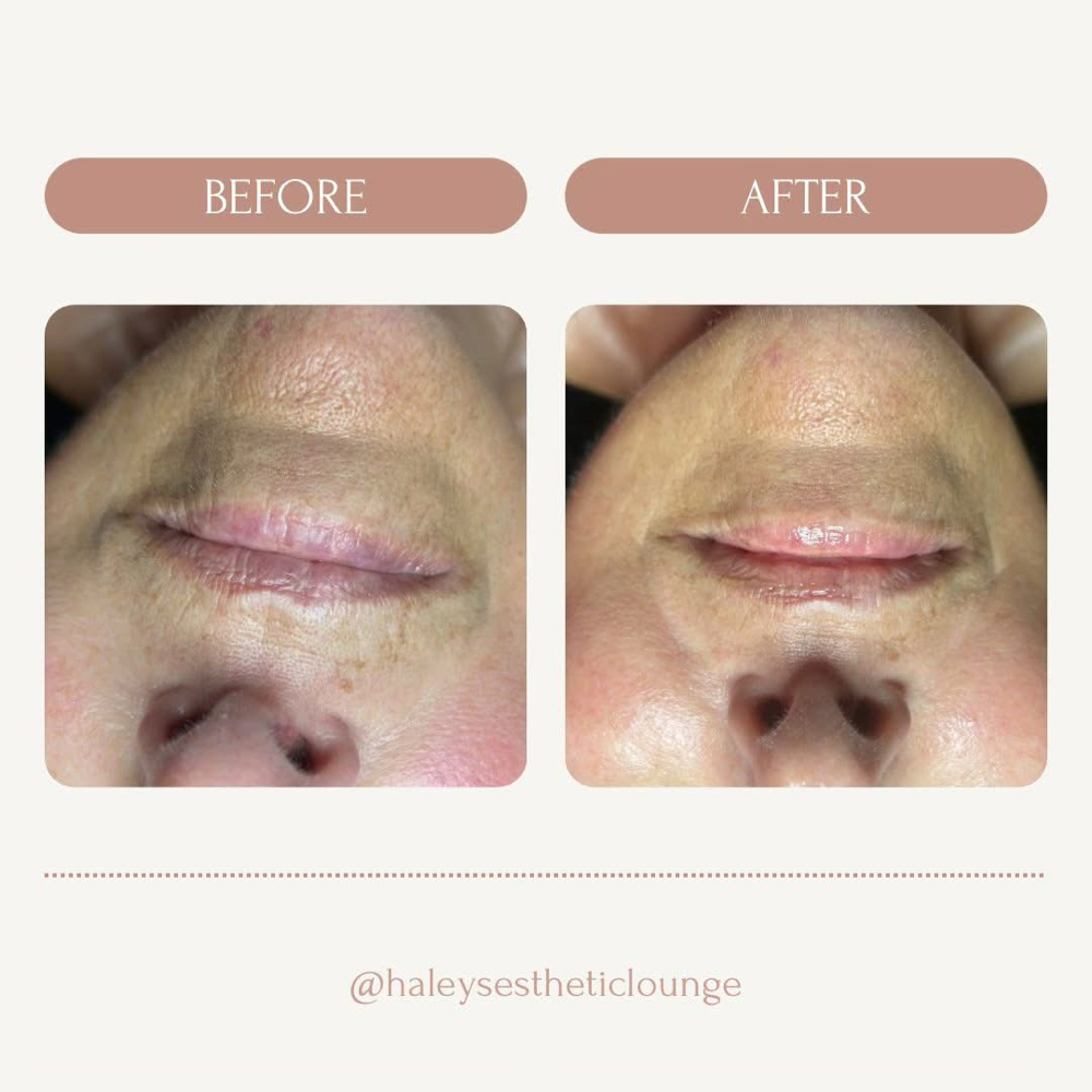 Luxe Lift Facial