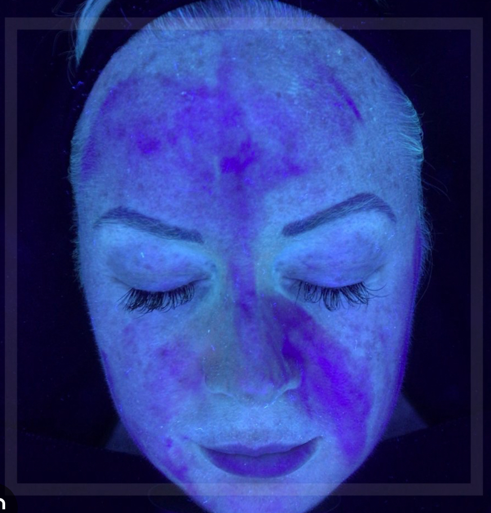 Skin Analysis