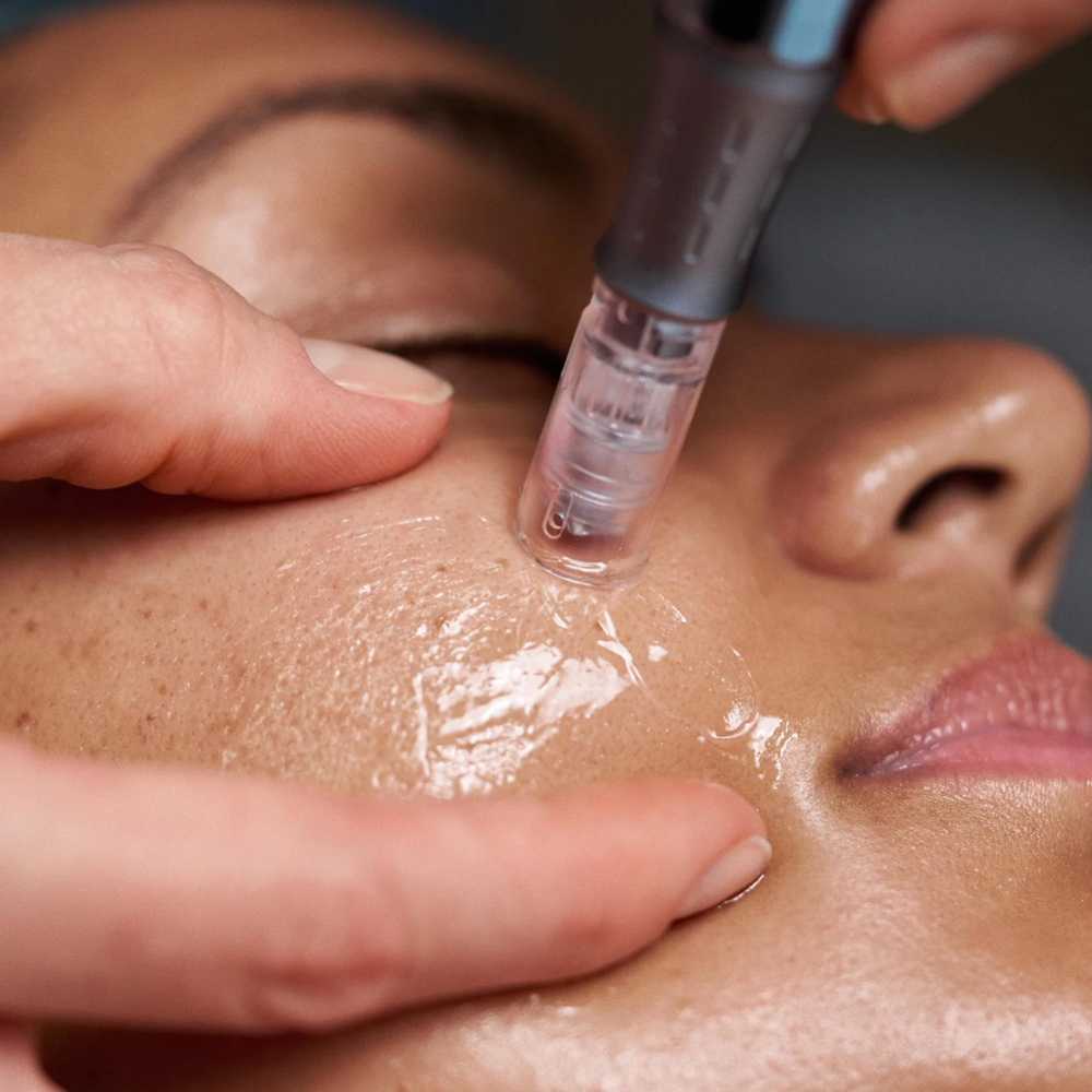 Nano Infusion Facial Treatment at Fairy Glow Studio in Toledo, OH