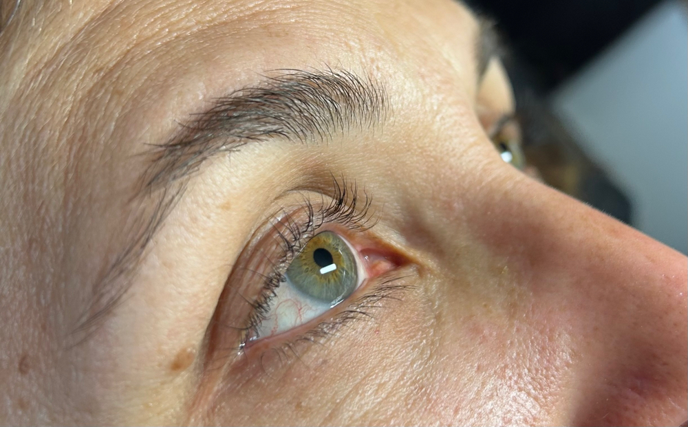 Lash Lift