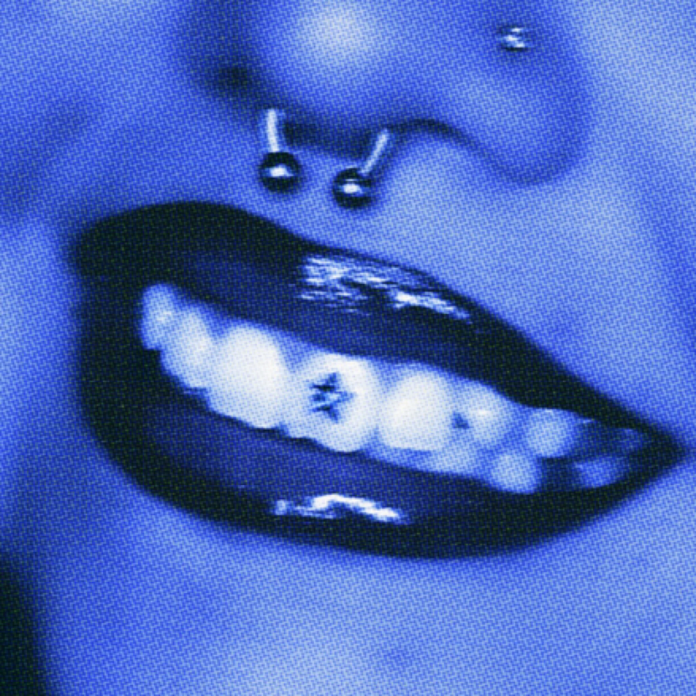 Tooth Gem Removal at Solecita Gems in Los Angeles, CA