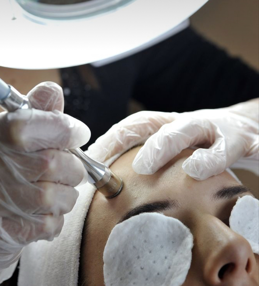 Microdermabrasion- ADD ON at Esthetics with Ali in Burleson, TX