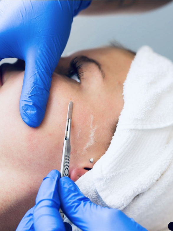Dermaplane Exfoliation