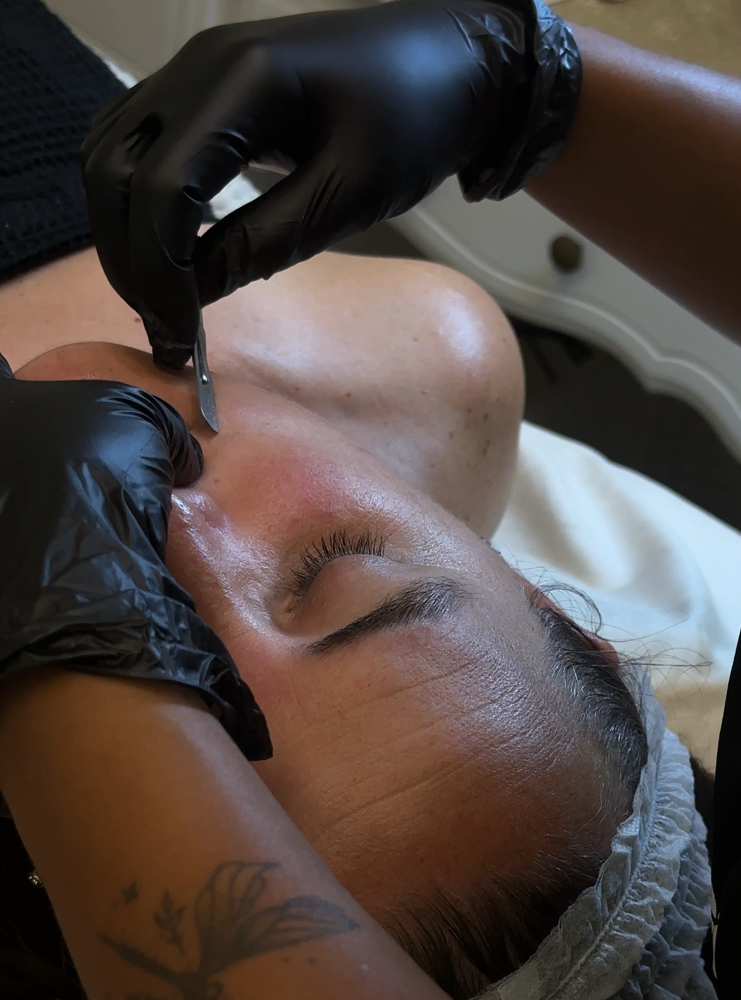 Skin Treatment Consultation