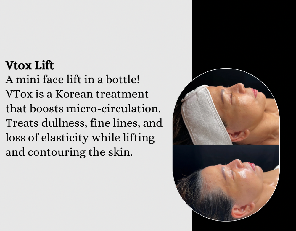 VTox Lift