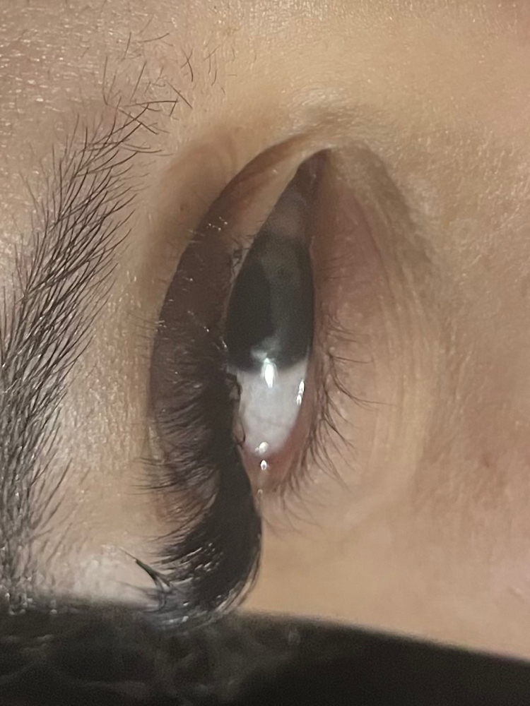 Volume Fill