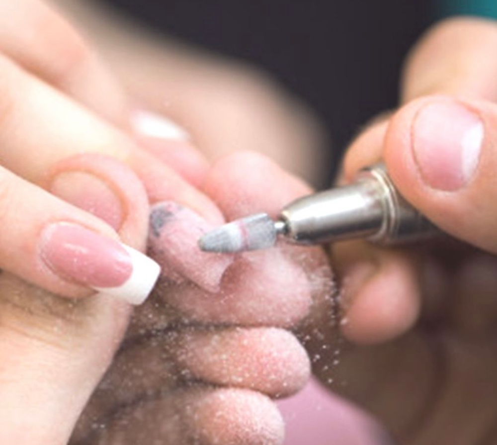 NAILS REMOVAL