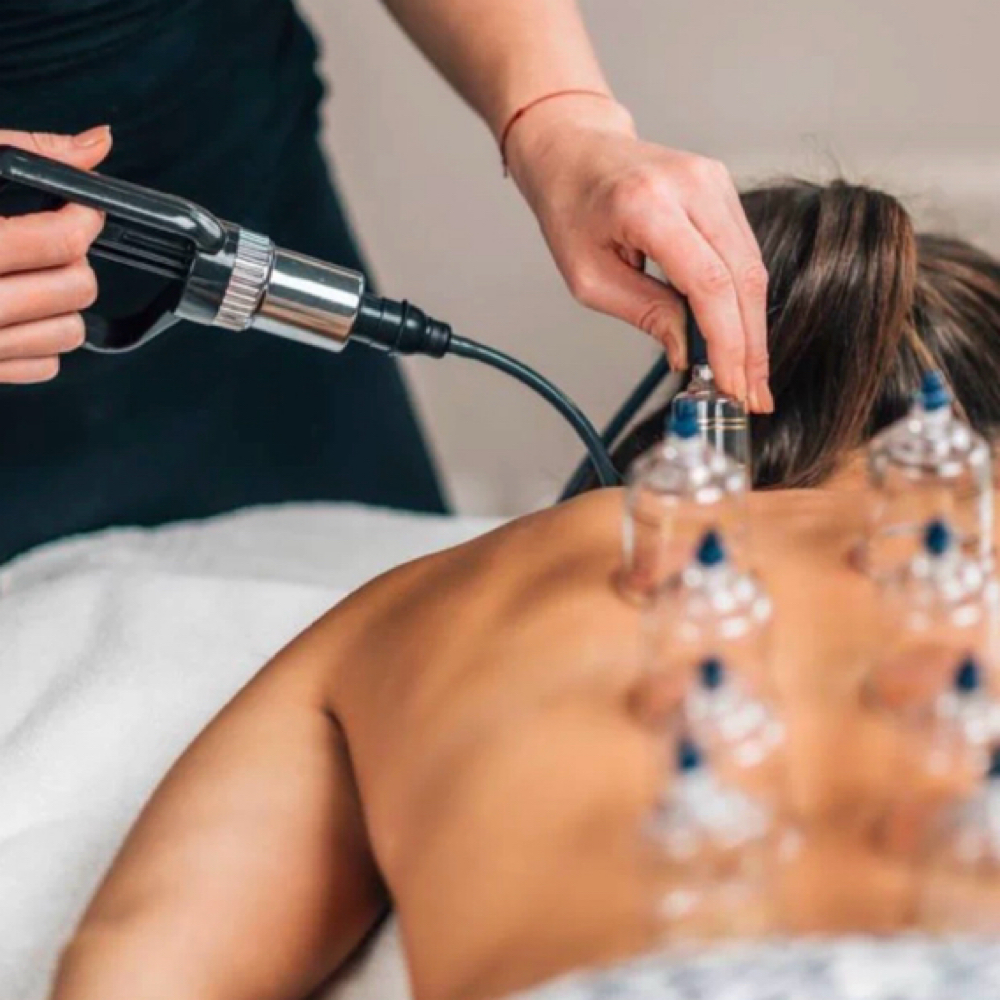Cupping Therapy | 60 Minutes at Luxxe Aesthetics in McMinnville, TN