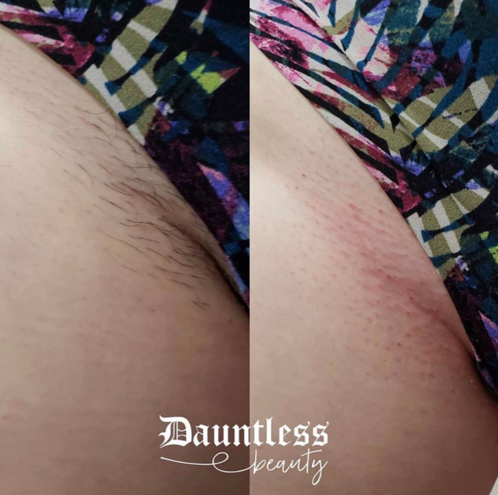 Brazilian Wax