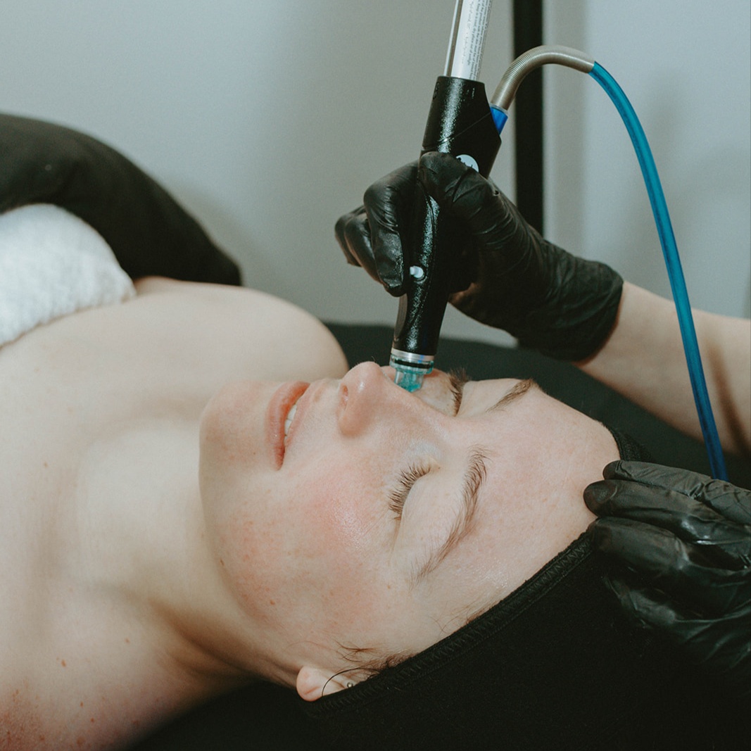 Advanced Treatment Facial(Tier 2) at Skin by Amanda in Dayton, OH