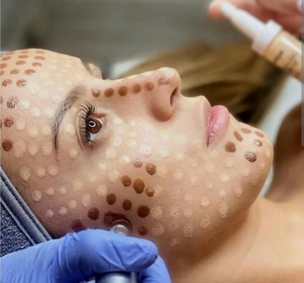 BB Glow Facial