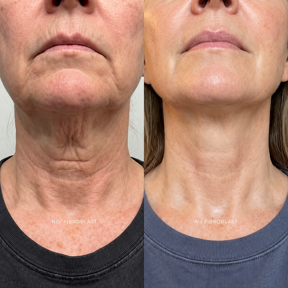 FBROBLAST | CUELLO at EROXSPA in Houston, TX
