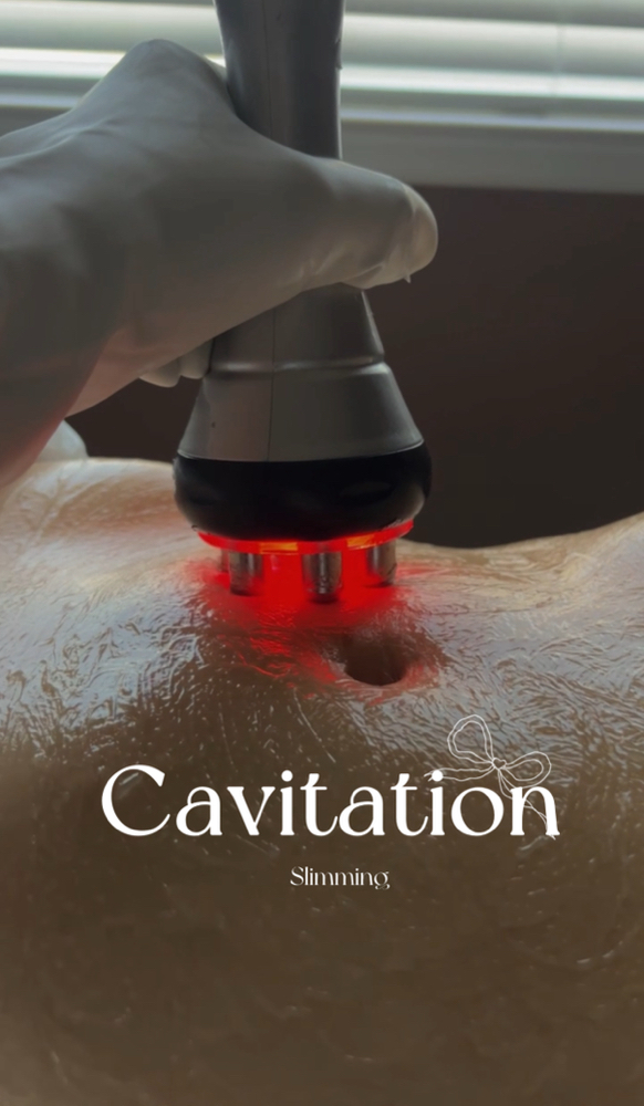 Body Contouring Treatment at Vogetica Beauty Lab (Regina) in Dallas, TX