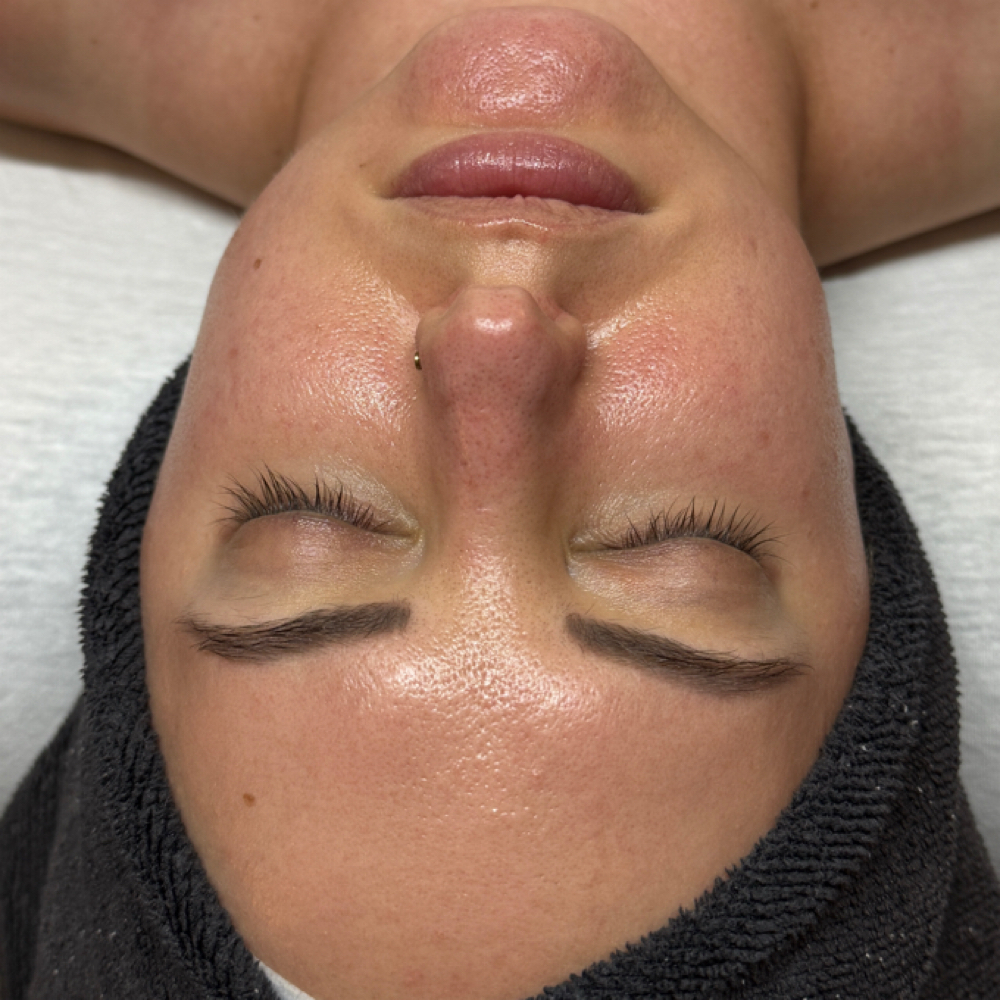 Sensitive Skin Facial at Dawn Apothecary Esthetic Suites in Warner Robins, GA