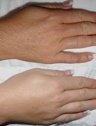 Waxing - Hands/Fingers