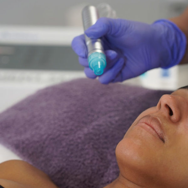 hydrodermabrasionfacial w/ oxy infu