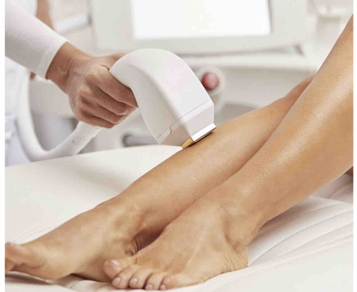 Laser Hair Removal