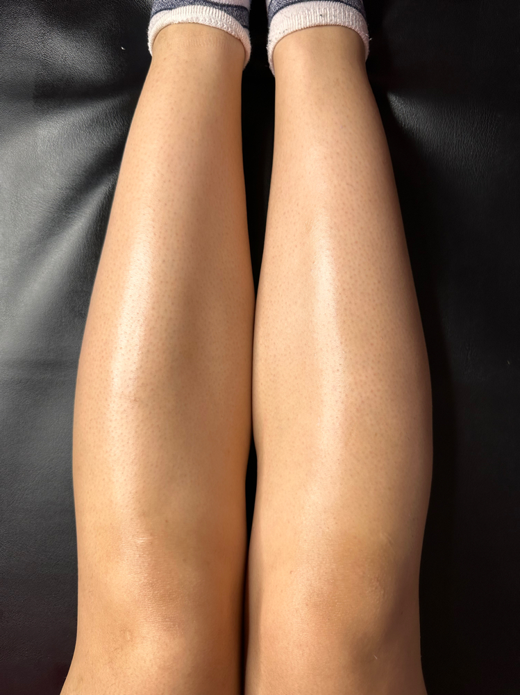 Full Legs