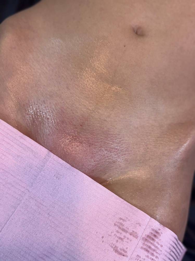 Brazilian Wax