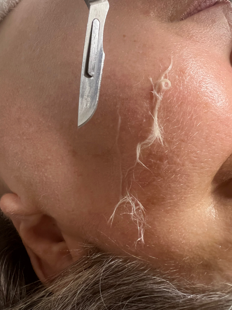 Dermaplaning Add On