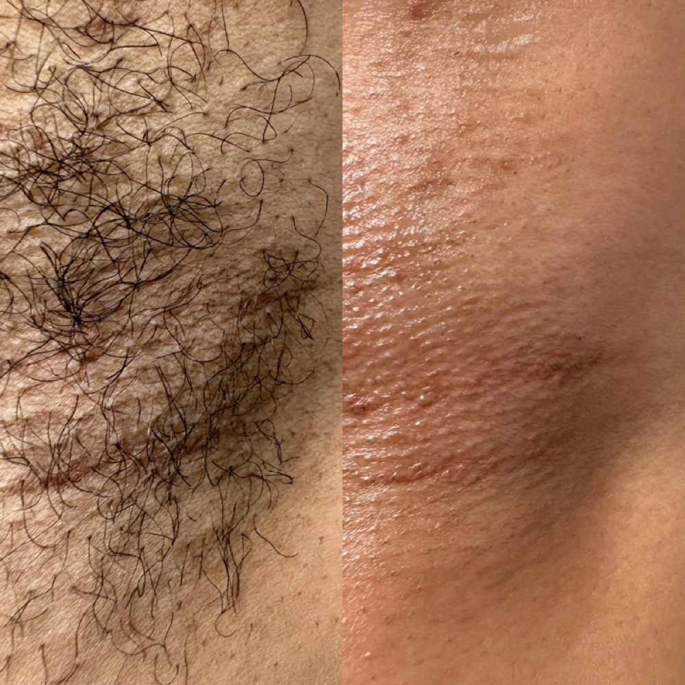 Underarm Wax at Elevate Salon & Spa Studios in Columbia, MO