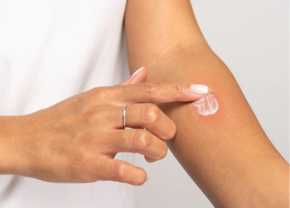 Free Patch Test
