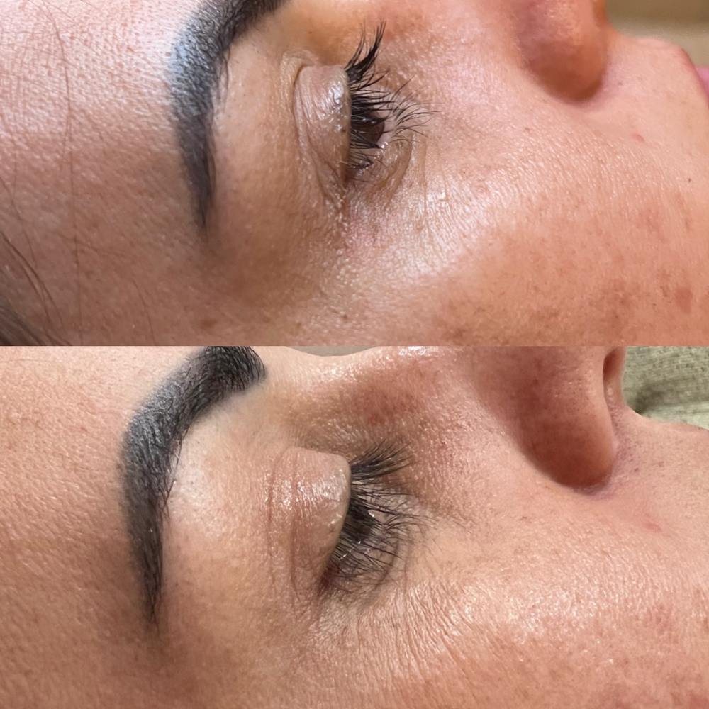 Lash Lift