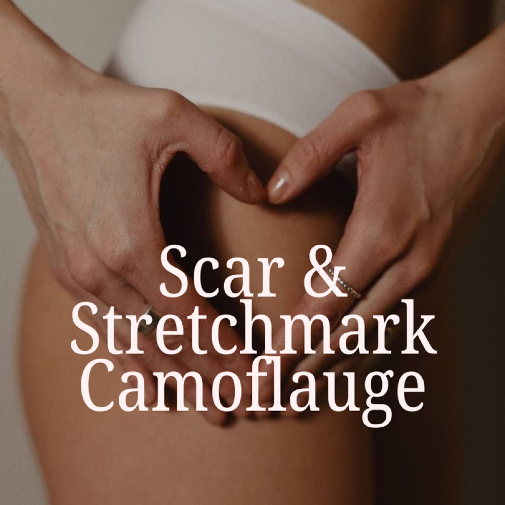 Scar & Stretchmark Revision/Camo at Chez Shae Ink in Cleburne, TX