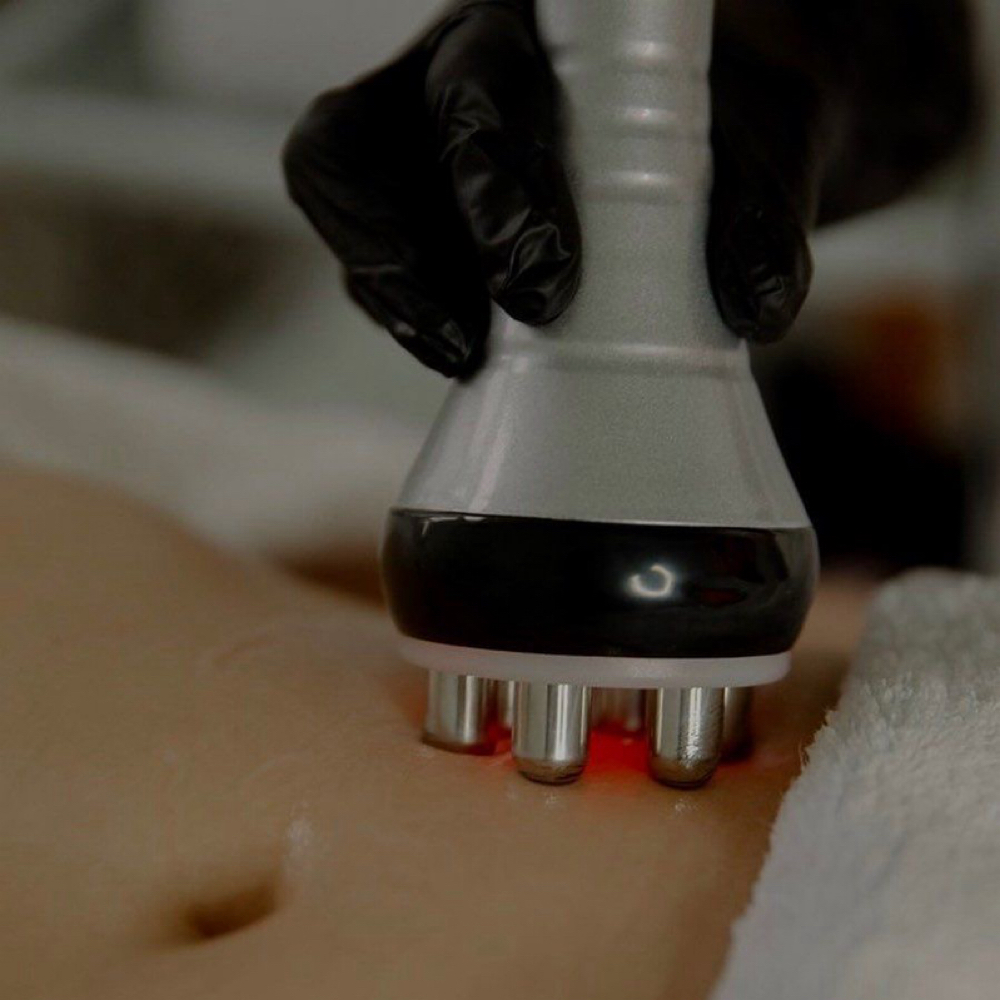 RF & Cavitation Body Treatment at vallusa skincare & brows in miami, FL