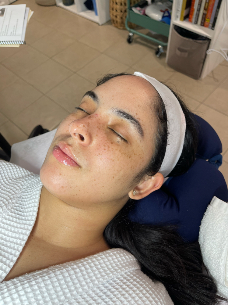 Microdermabrasion Facial