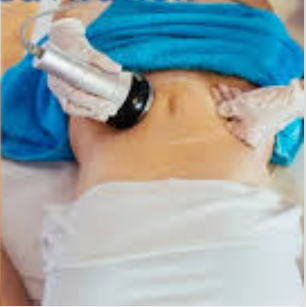 Ultrasonic Cavitation