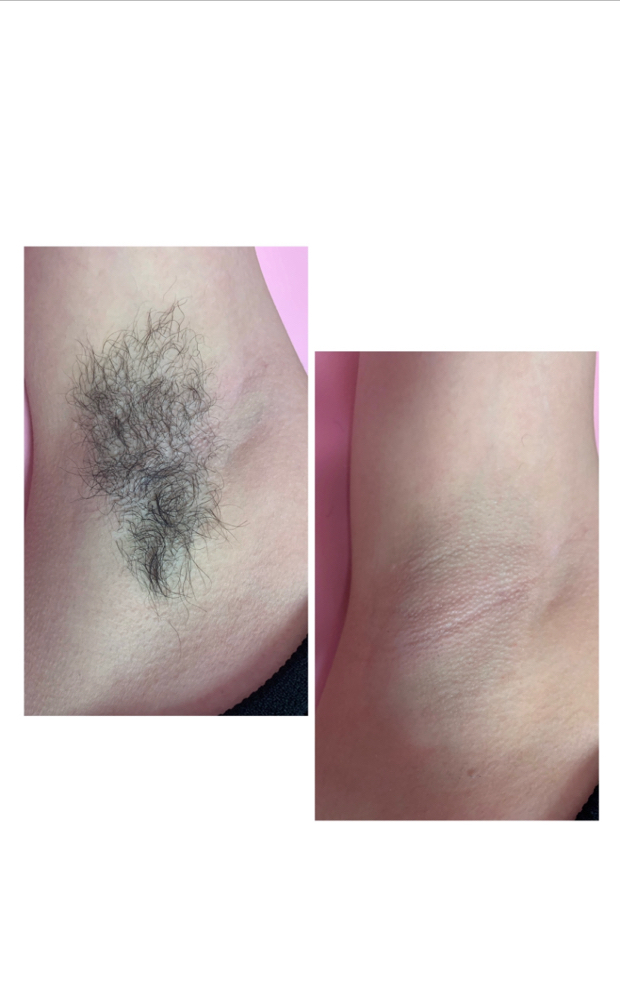 Under Arm Wax