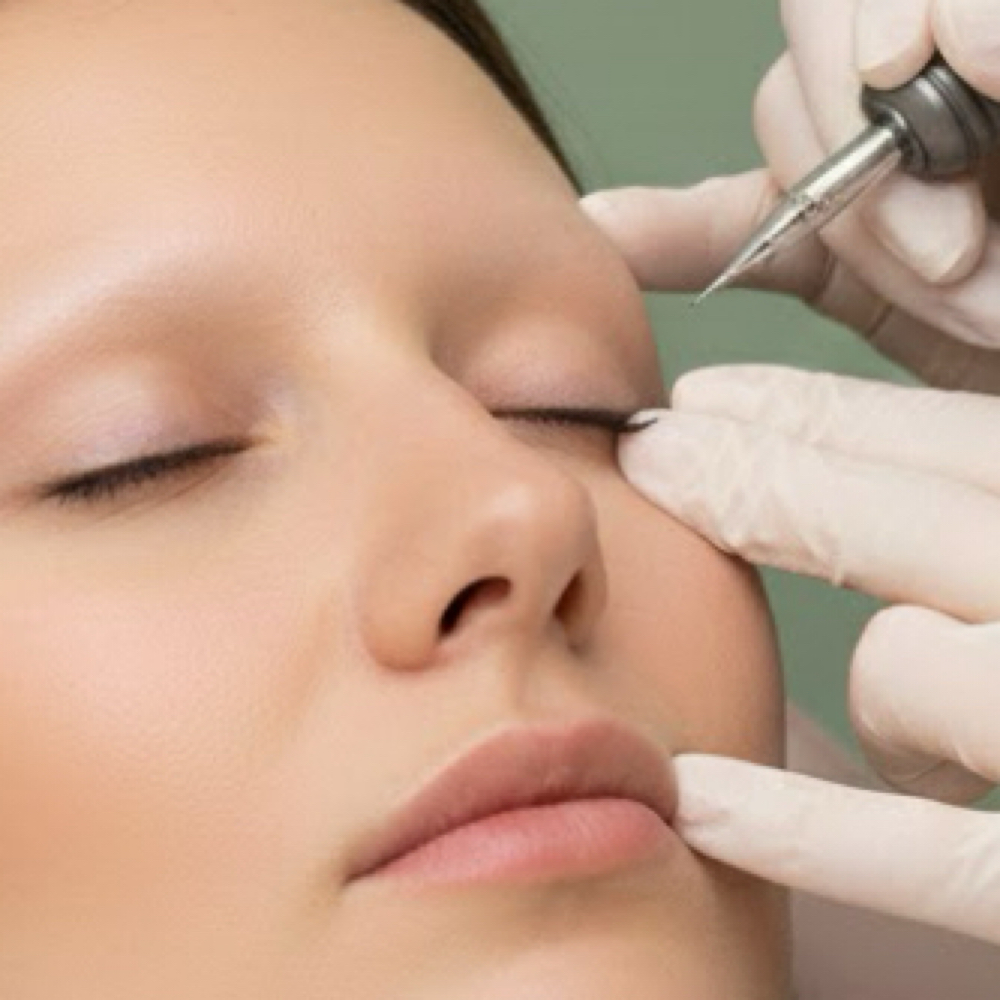 Lower Eyeliner Initial Session at Glow Haven Esthetics & Wellness in Largo, FL