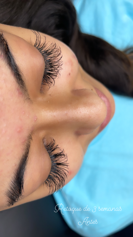 Hybrid Set 3 Week Fill
