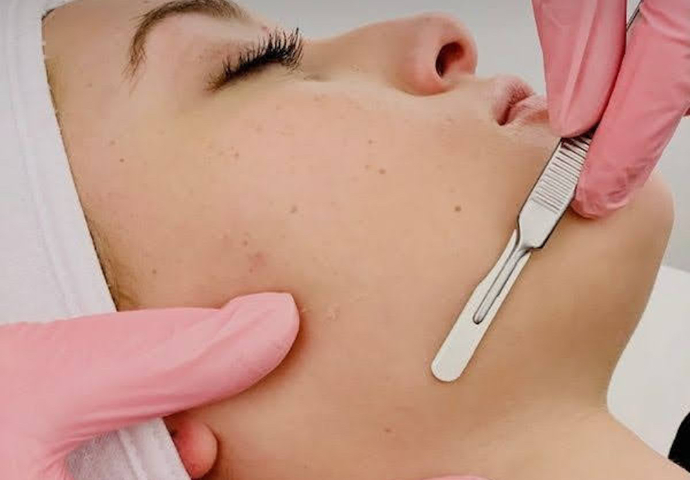 Dermaplaning Facial W/LED Therapy