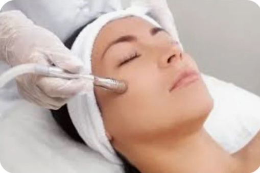 Microdermabrasion Facial