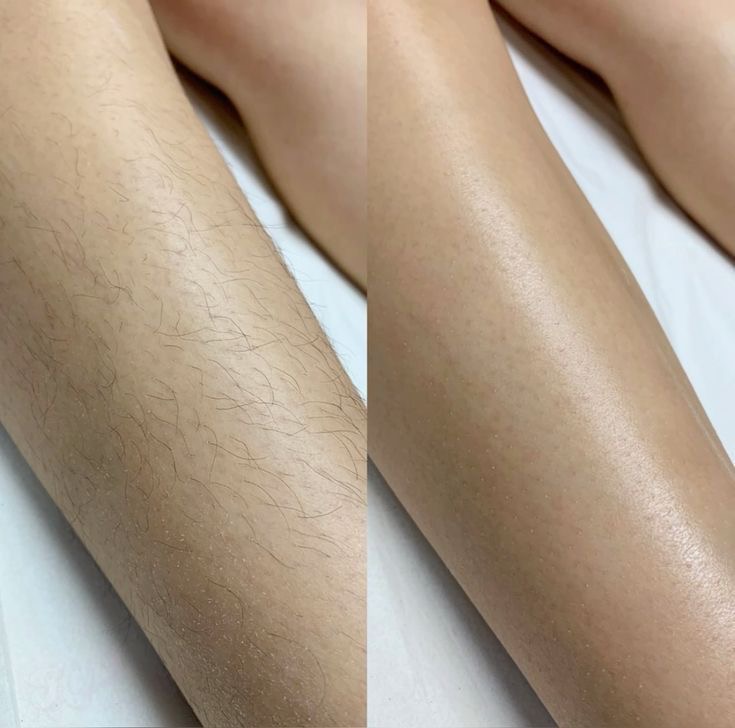 Lower Leg Wax